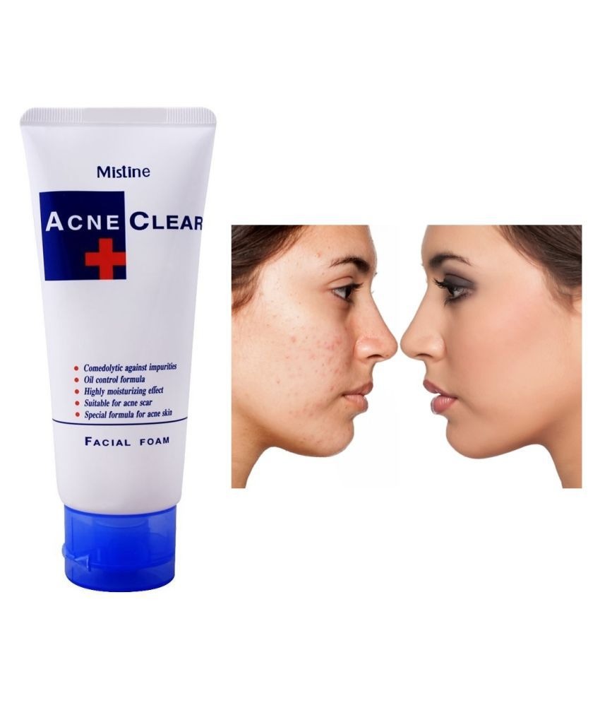 Acne Control Face Wash – Deep Cleansing & Oil Control for Clear Skin