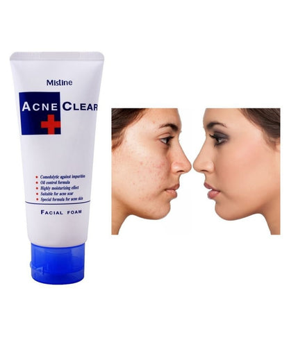 Acne Control Face Wash – Deep Cleansing & Oil Control for Clear Skin
